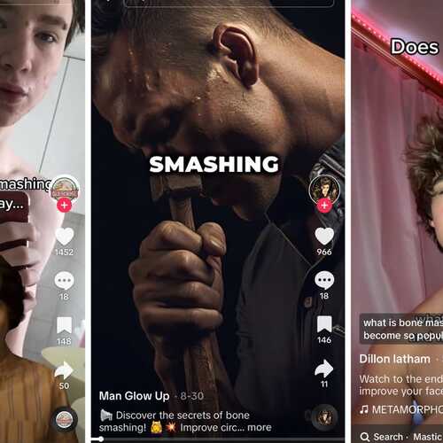 TikTok Myth of the Week: ‘Bone Smashing’ Will Make You Beautiful