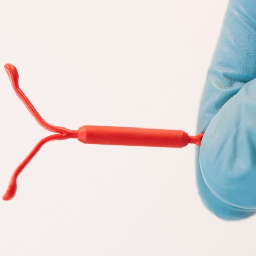 The CDC’s IUD Guidelines Finally Include Pain Management